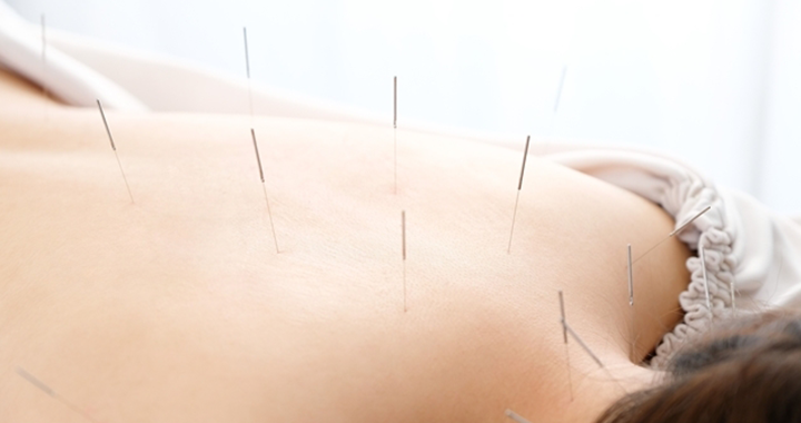 夫婦で受ける妊活鍼灸